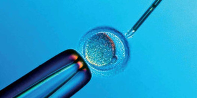Everything You Need to Know About In Vitro Fertilization (IVF)